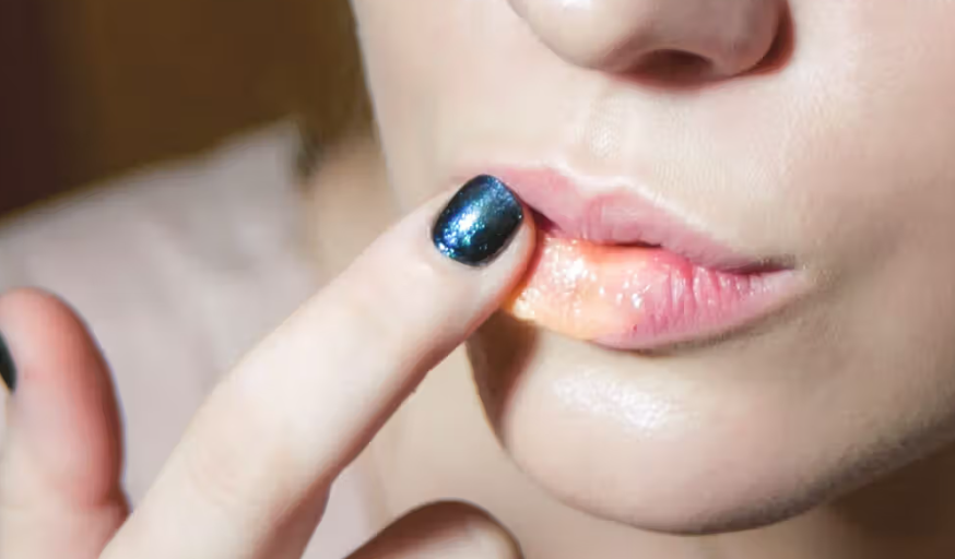 Can lipsticks assist to heal cracked lips?